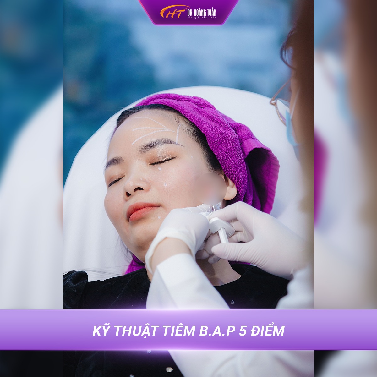 tiêm BAP bao lâu có hiệu quả